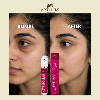 Aptlura Eye Roller – Dark Circle & Puff Care (20ml)