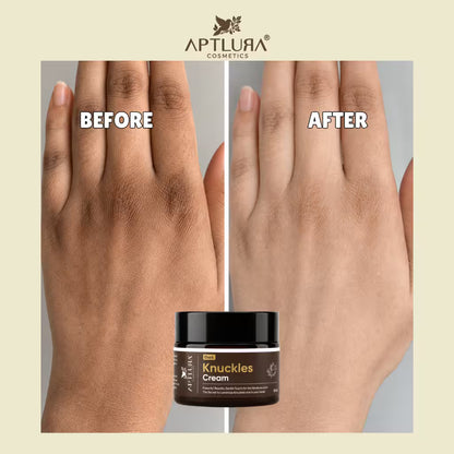 A split-screen before-and-after comparison showing hands with dry, cracked skin on the left and smooth, hydrated skin on the right, with the text 'BEFORE' and 'AFTER' overlaid. A small jar of APTLURA Cosmetics Knuckles Cream is centered at the bottom.
